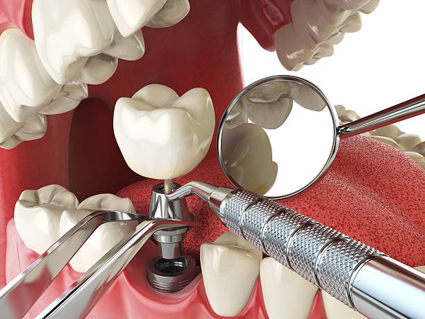 Best Emergency Broken Tooth Repair in Troy Hills, NJ